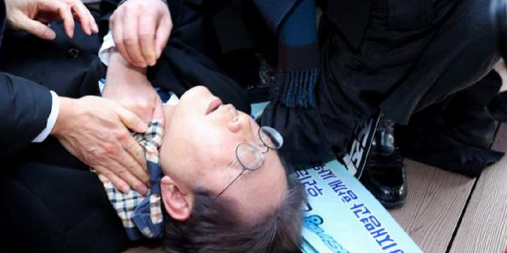 चक्कू प्रहारबाट घाइते दक्षिण कोरियाली नेता लीको स्वास्थ्यमा क्रमिक सुधार : चिकित्सक