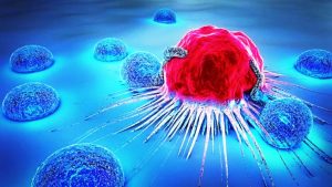 आज विश्व क्यान्सर दिवस : क्यान्सरबाट हरेक वर्ष दश लाख मानिसको मृत्यु