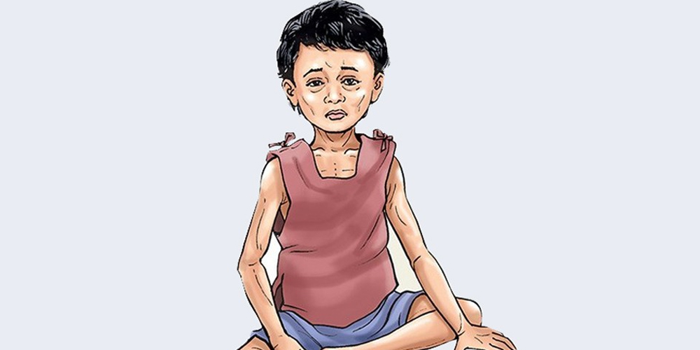 नेपालका बालबालिकालाई तीन वर्षभित्र कुपोषणमुक्त गर्ने अभियान सुरु