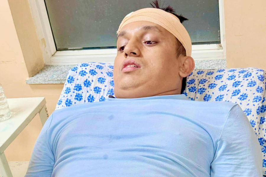 रास्वपा नेतामाथि कपनमा आक्रमण, टाउकोमा १० टाँका