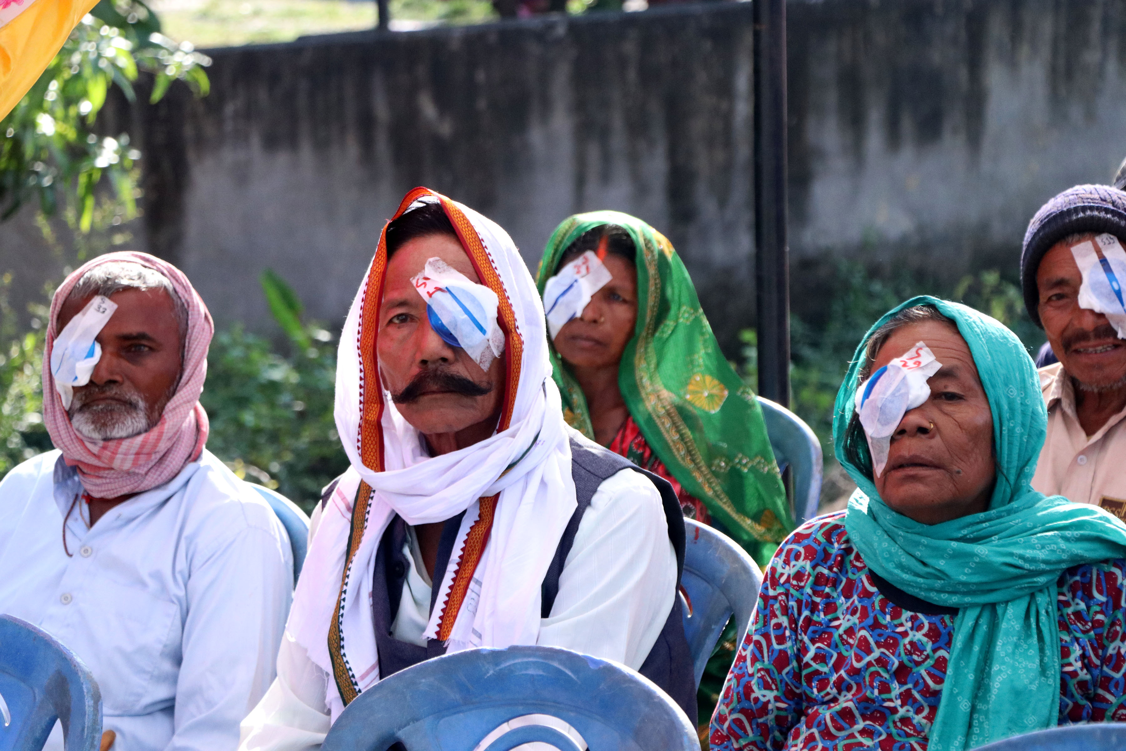 सर्लाहीको बागमतीमा निःशुल्क आँखा शिविरमा ३६१ जनाको आँखाको शल्यक्रिया
