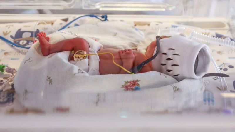 ‘समय नपुगी जन्मिएका शिशुको एक महिनाभित्र अनिवार्य परीक्षण गराउनुपर्ने’