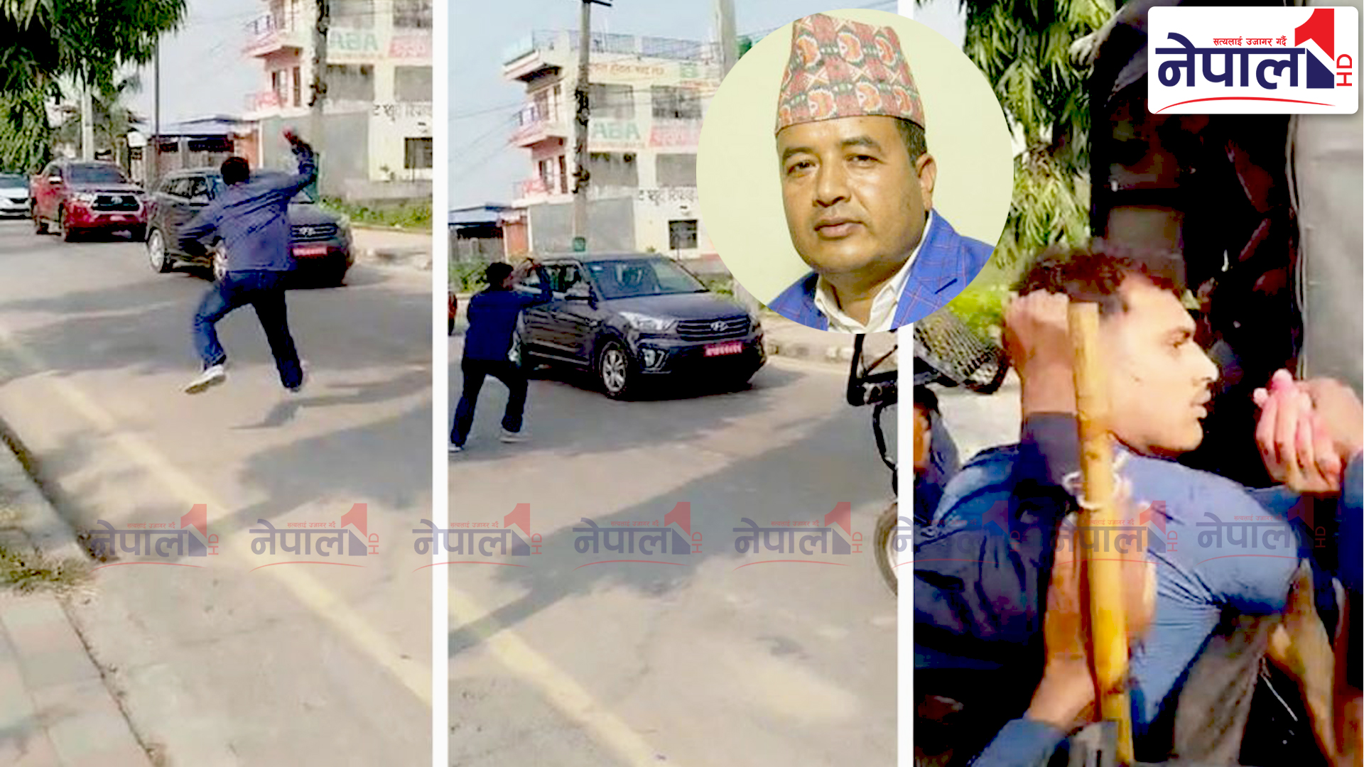 मसी प्रहारपछि महेश बस्नेतले भने–आक्रमणको प्रयास गम्भीर र निन्दनीय