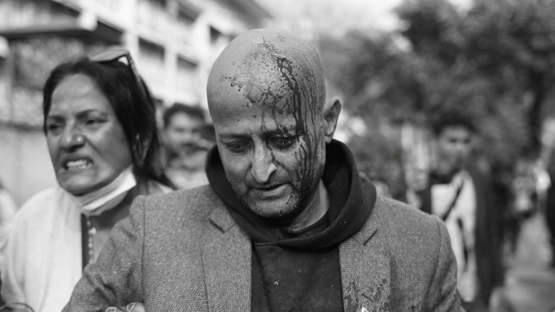 प्रहरीले लाठीचार्ज गर्दा एमाले प्रदर्शनकारी घाइते