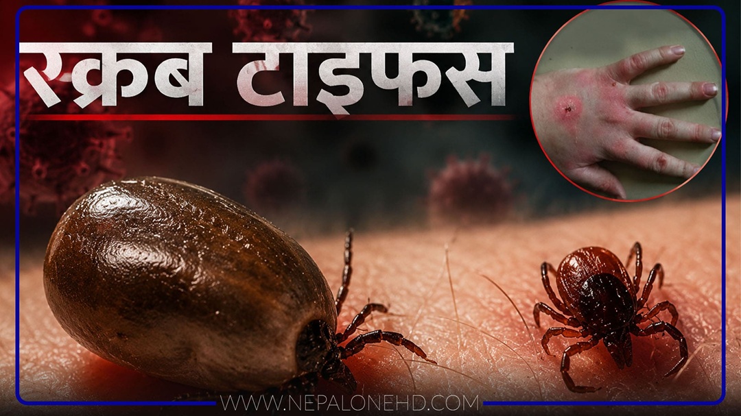 स्क्रबटाइफसबाट एकको मृत्यु