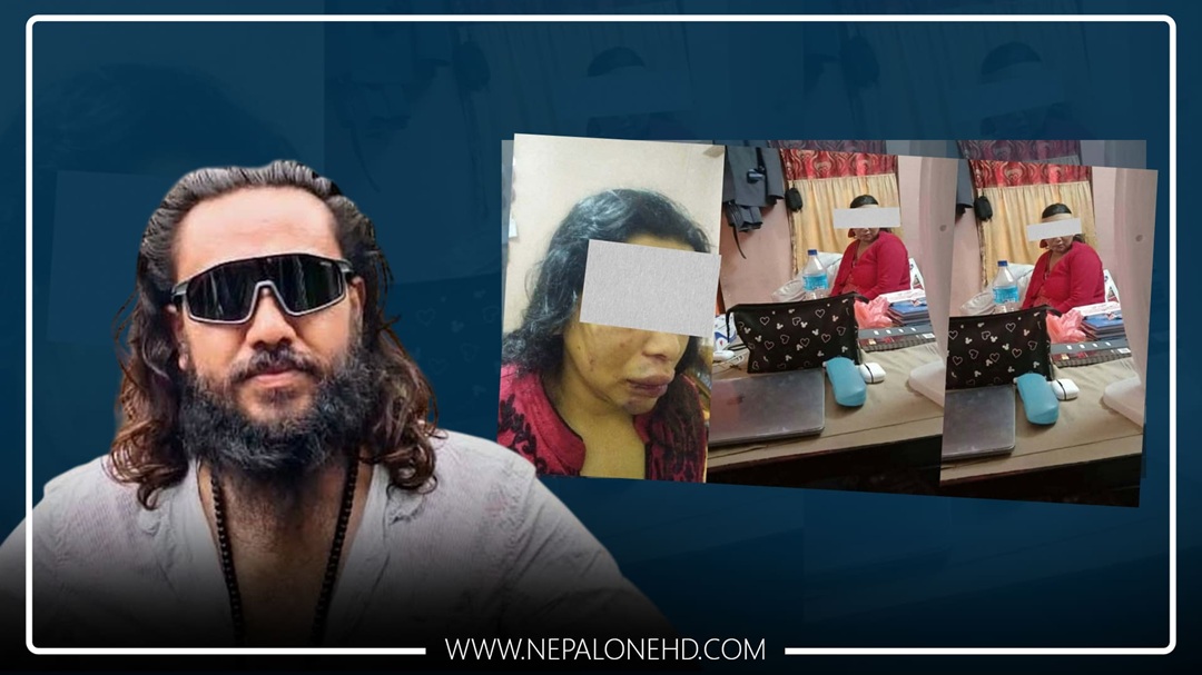 खगेन्द्र सुनारको कुटपिट प्रकरण : मिलापत्र गरेर छुटेको खुलासा!